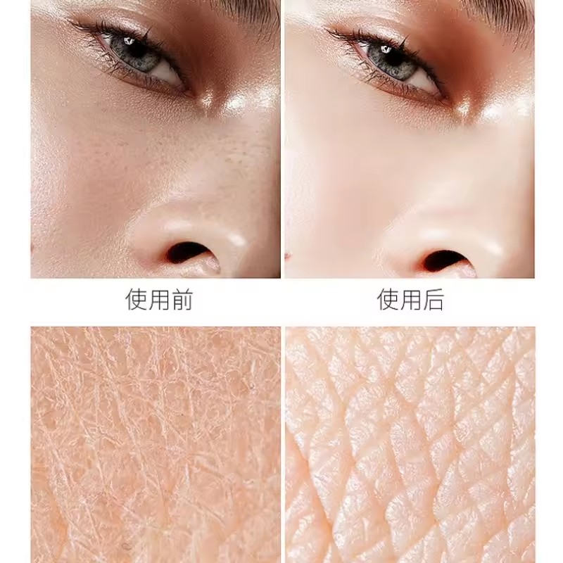 Hyaluronic Acid Niacinamide Es - Niacinamide Pore Shrinking Essence review and price