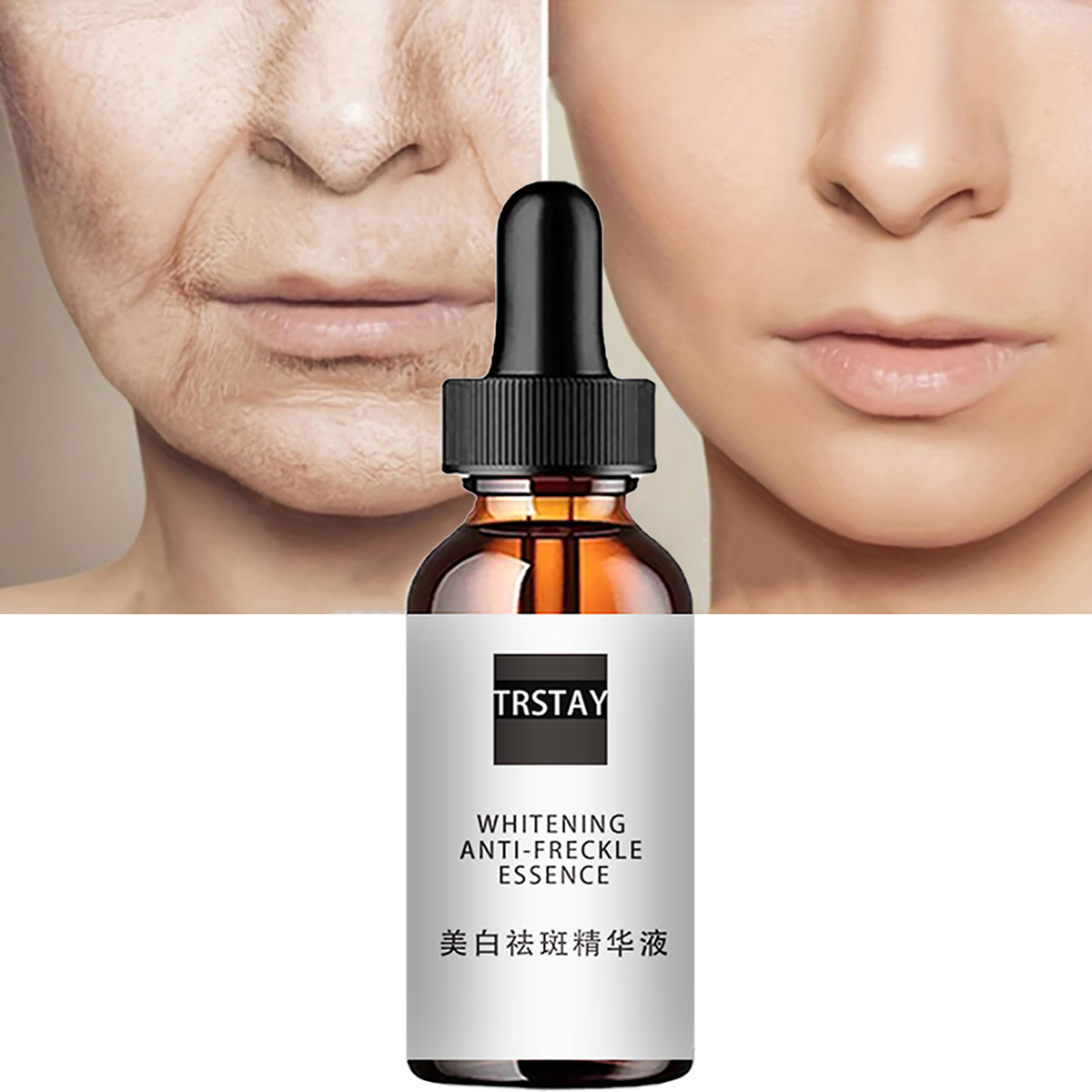 Niacinamide Acid Facial Essenc - Niacinamide Pore Shrinking Essence review and price