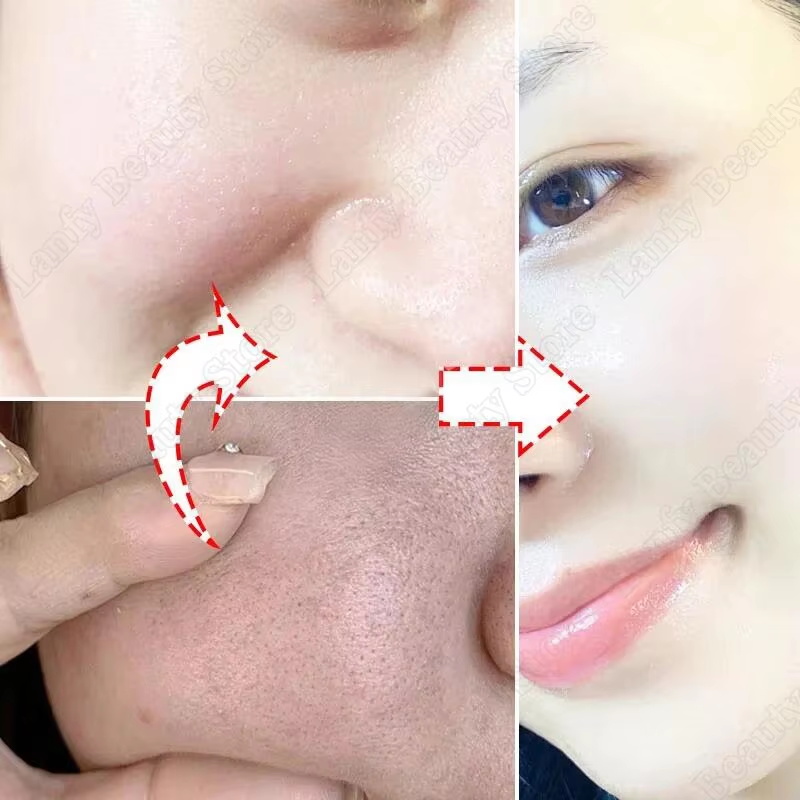 Salicylic Acid Pore Clearing C - Salicylic Acid Blackhead Remover review and price